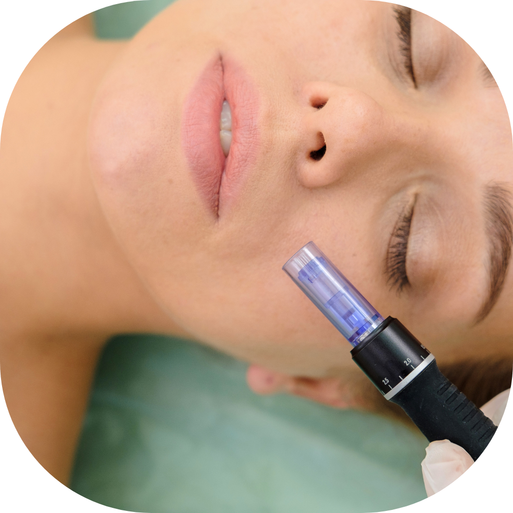 mesoterapia axa